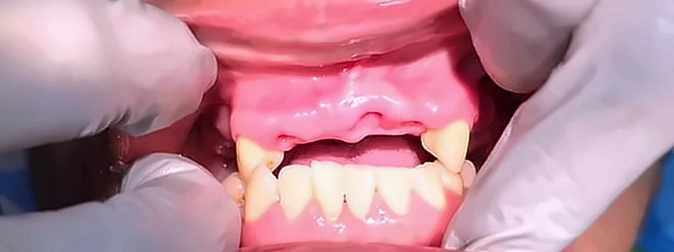 Antes: encía superior sin dientes entre los colmillos