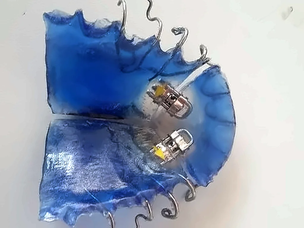 Placa de ortopedia de acrílico azul con tornillo