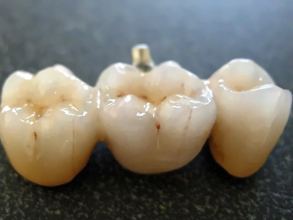 Puente de tres piezas de porcelana sobre la mesa